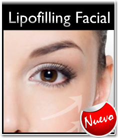 Lipofilling Facial